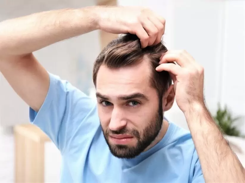 Calvitie : Les solutions pour freiner la chute